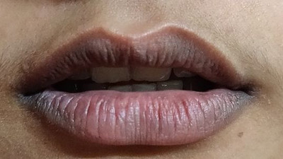 Dudaklarınızda morluk varsa, korona testi yaptırın