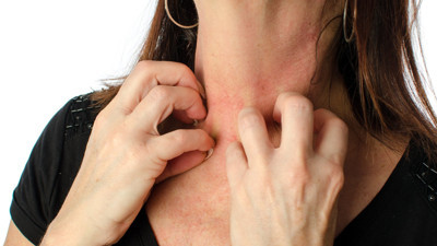 Vücudunuzdaki kaşıntının sebebi bu olabilir