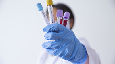 Kovid tanısı kesinleşmeden çocuğunuzu okula göndermeyin