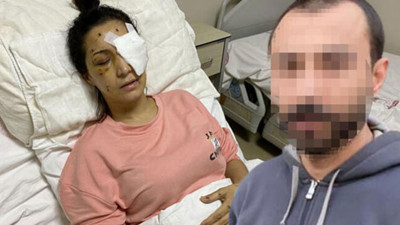 Mehtap öğretmen gözünü kaybetti! Eşinin kardeşi canavarca saldırdı
