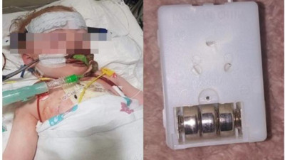 Oyuncak maymun 1 yaşındaki bebeğin sonu oldu