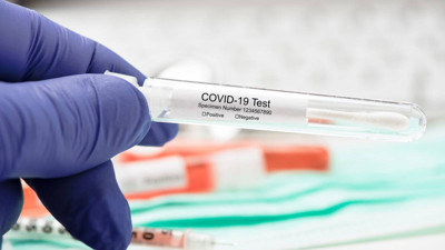 Bu şehirde kovid-19 testi yaptıranların yarısı pozitif çıkıyor