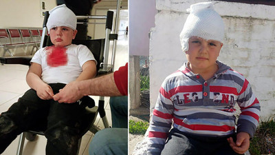 Pitbull melezi 6 yaşındaki Hüseyin'i paramparça etti! Artık bu vahşete dur deyin…