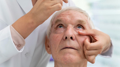 75 yaşın yüzde 20’sinde görülüyor