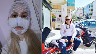 Yüzüne kimyasal madde atılan Sultan: Onun ev hapsi bitti, benimki başladı