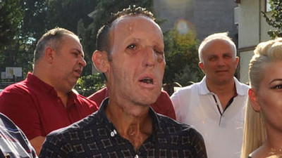 Yüz nakli yapılan Recep Sert gözaltına alındı