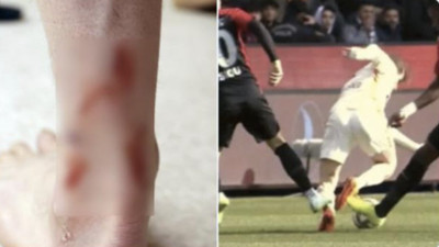 Galatasaray, Kerem'in ayağını paylaştı: Karşılığında kart yok!