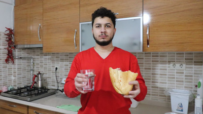 Hastalığı ile tıp tarihine geçti. Doktorlar tanı bile koyamıyor