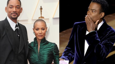 Jada Pinkett Smith, hastalığını anlatırken şöyle demişti: ''Avucum saçlarımla doldu''