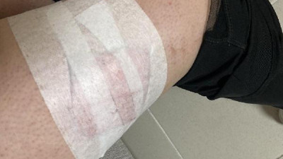 Artık yeter biri bu tehlikeye dur desin. Kampüste köpek saldırısına uğradı