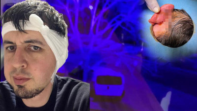 Durdurun bu vahşeti! Durağa yürürken sokak köpekleri saldırdı. Kulağı kopmak üzereydi