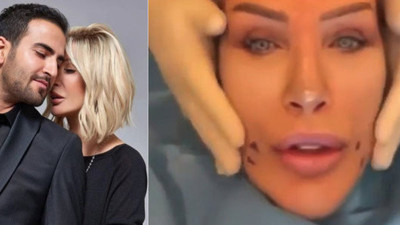 Seda Sayan düğün öncesi yüzünü gerdirdi!