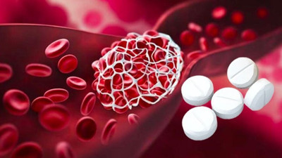 Kan sulandırıcılara dikkat! Kontrolsüz kullanımı ölüme neden oluyor