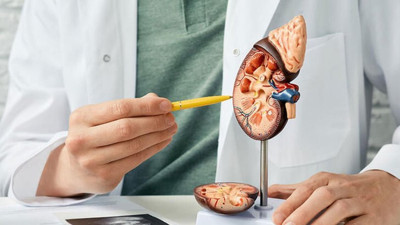 Yeni keşfedildi! Böbrek hastalığı olanlarda kanser riski yüksek