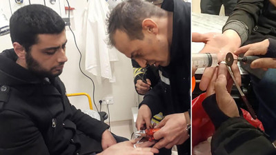 İtfaiyeden acil serviste ‘yüzük’ operasyonu