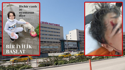 8 köpeğin saldırısında ölümden döndü! Ömer Efe sokak hayvanları projesinde görev almış…