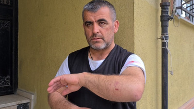 Sokak ortasında öldüresiye dövdüler, 73 bin lirasını gasbettiler