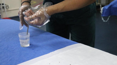 Yaz aylarının korkulu rüyası kene tutulmalarına karşı önemli uyarı