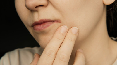 İşte uçuklarınızı yok edecek 8 yöntem