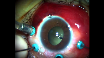 Ölümü yenme ihtimali var (mı)? (13 Mayıs 2022)