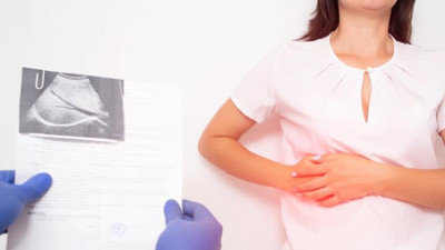 Safra taşı olanlar dikkat. Kanser olabilirsiniz