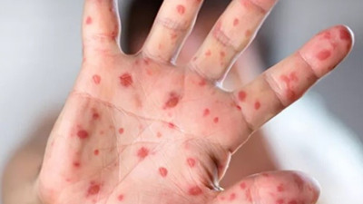 Dünyanın yeni belası o hastalıkla ilgili Türk biliminsanlarından açıklama geldi