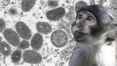 Korona bitti maymun çiçeği başladı. 23 ülkeye yayıldı. Dünya Sağlık Örgütü’nden endişe veren açıklama