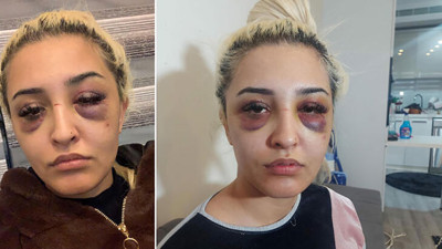 Eski sevgili dehşetinde şok eden gelişme. 3 saat aralıksız dayak yemişti