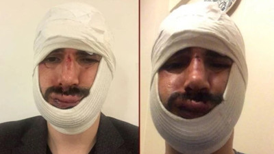 Anadolu Ajansı muhabirine saldıran iki sanığa hapis cezası