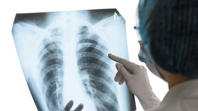 Türk erkekleri sigaradan kaynaklanan ölümde dünyada korkutan sırada