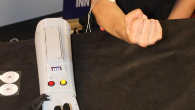 Metrodaki tek kollu kızdan etkilendiler. Kasla çalışan biyonik kol yaptılar