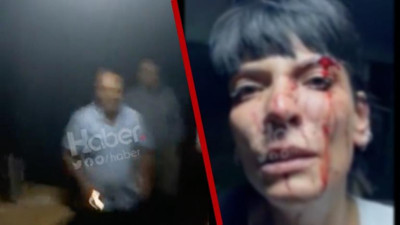 Altı kadına dehşete düşüren saldırı. Arkadaşlarını toplayıp geldiler