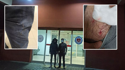 Baba-oğul kendi köpeklerinin saldırısına uğradı