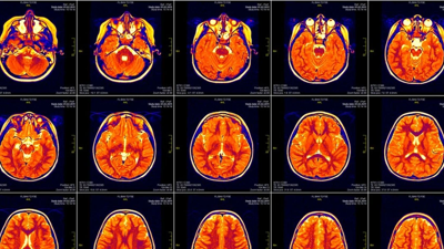 İnsan beyninin ısısı ölçüldü