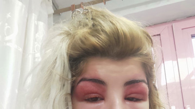 Güzellik merkezi kabusu oldu