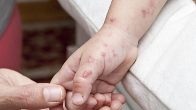 Bilim insanları 45 bin kişiyi inceledi, "10 kat artabilir!" dedi