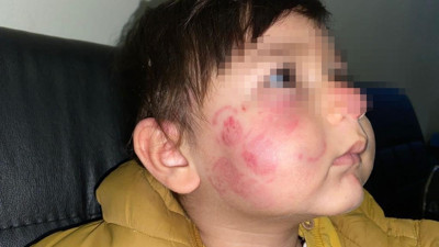 İstanbul'da kreşte dehşet. 17 aylık bebek dakikalarca darp edildi. Yok artık