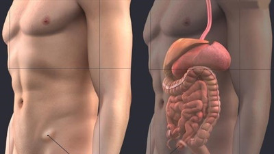 Op,Dr. Faydacı: Tedavi edilmeyen kasık fıtığı organlara zarar verebiliyor