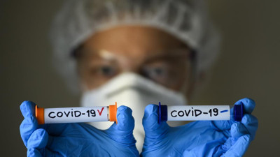 Korona virüs ihalesi sağlıkla ilgisi olmayan beşli çeteden birine verildi. Yok artık