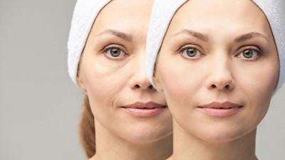 30 yaşına geldiğinizde 50 yaşında gibi görünmek istemiyorsanız bu besinleri tüketin