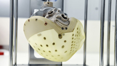 Hollanda'da yapay kalp nakli yapılan ilk hasta 8 ay yaşayabildi