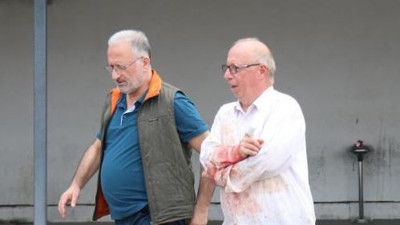 Yaralanan acemi kasaptan şaşırtan açıklama