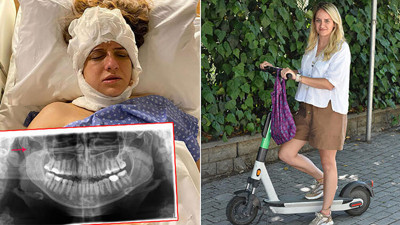 Elektrikli scooter tehlikesi büyüyor! 5 dakikalık yolculuk için 7 ay tedavi gördü…