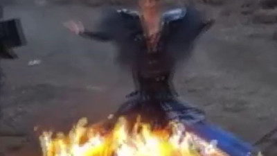 Mankenin zor anları. Elbise tutuştu ölümden döndü