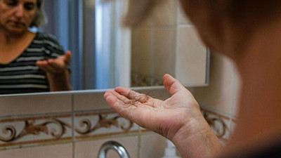 Uzmanı açıkladı. Dökülen saçları geri kazanmak için ne yapmak gerekir?