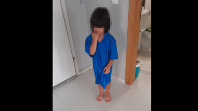 Yanlış sünnet edilen çocuğun hayatı karardı. 21 gündür su içmeye korkuyor