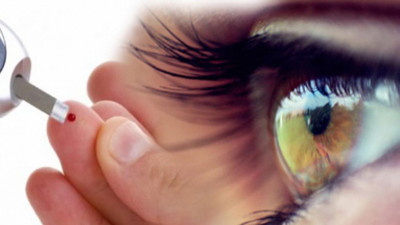 “Diyabet hastası düzenli göz muayenesi yaptırmalı”