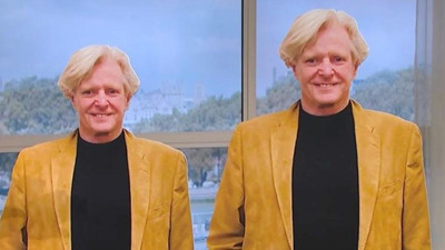 68 yaşındaki adam boyunu uzatmak için servet ödedi. Son halini görenler şaştı kaldı