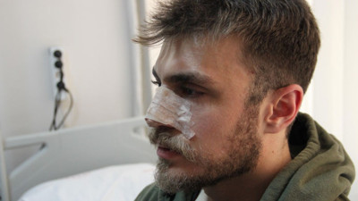 'Eşimi erkek doktor muayene edemez' dedi. Asistan doktorun burnunu kırdı