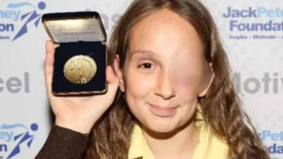 Nadir görülen hastalığa yakalandı. Önce gözünden sonra canından oldu